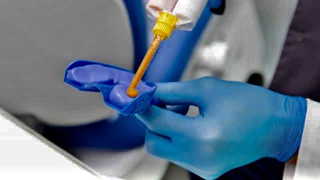 Teeth grinding increased through the epidemic says, dentists.